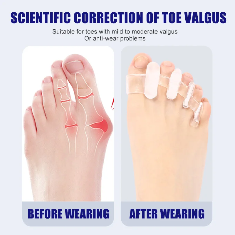 1 Pair Silicone Toe Separator  - đánh giá và giá Toe Separator Silicon