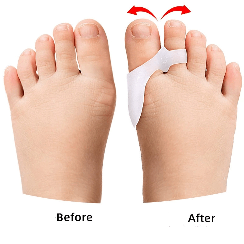 1/2/3Pairs Children's Gel Toe  - đánh giá và giá Toe Separator Silicon