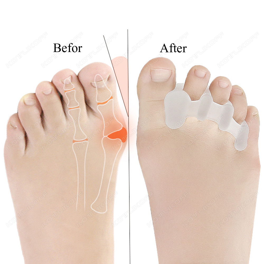 Toe Protective Toes Separator  - đánh giá và giá Toe Separator Silicon